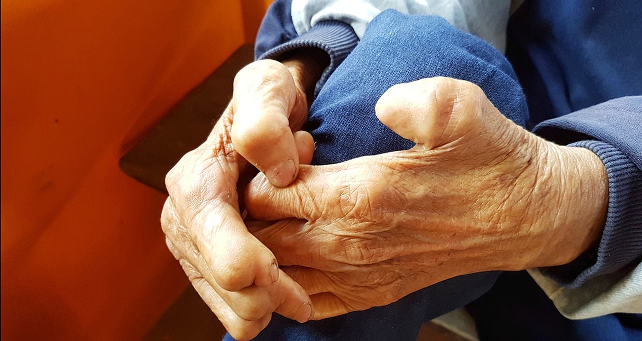 sadece kemikleriniz degil kaslariniz da erimesin 4bM2EHW2